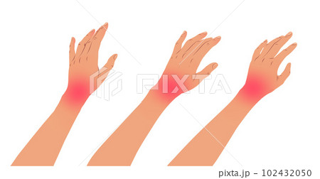 Left hands with carpal tunnel syndrome Left hands with carpal tunnel syndrome 102432050