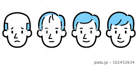 男性の薄毛進行イラスト 102452634