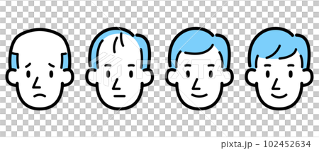 男性の薄毛進行イラスト 102452634