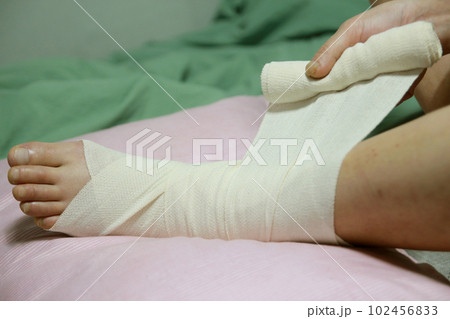 Concept of bandaging and treating an ankle injury at home Concept of bandaging and treating an ankle injury at home 102456833