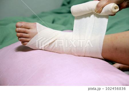 Concept of bandaging and treating an ankle injury at home 102456836