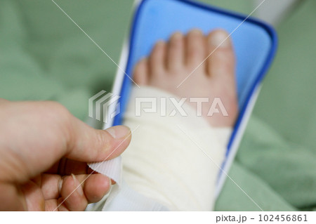 Concept of bandaging and treating an ankle injury at home Concept of bandaging and treating an ankle injury at home 102456861