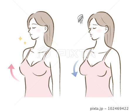 ハリのあるバストと垂れたバストの女性のイラスト　ビフォアアフター 102469422