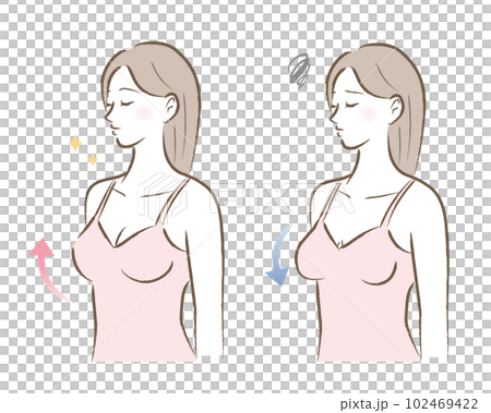 ハリのあるバストと垂れたバストの女性のイラスト　ビフォアアフター 102469422