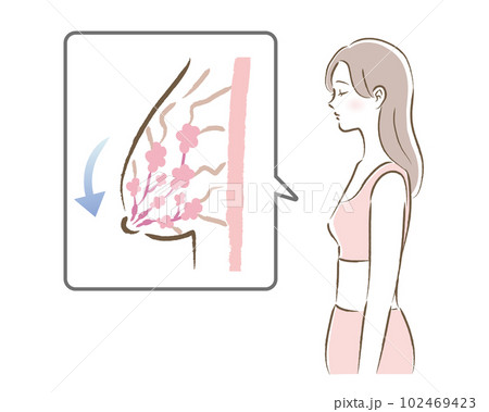 バストが垂れる図と悩む女性のイラスト 102469423
