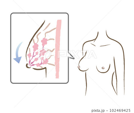 下垂したバストの図と体のイラスト 102469425