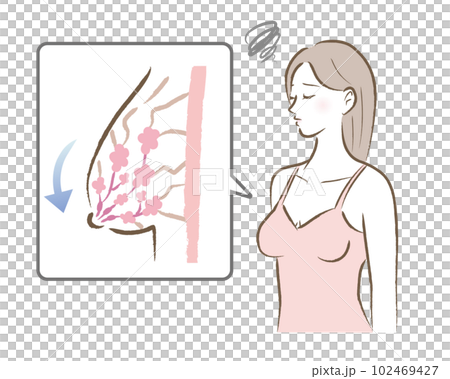 Illustration of a sagging bust and a worried woman Illustration of a sagging bust and a worried woman 102469427