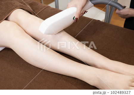 足の脱毛の施術を受ける女性 足の脱毛の施術を受ける女性 102489327