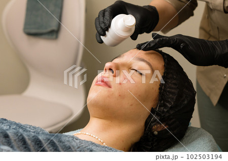 Cleaning face teenager. Acid organic peeling Cleaning face teenager. Acid organic peeling 102503194