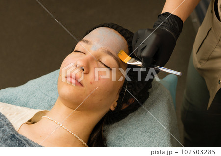 Acne treatment at doctor. Applying facial mask 102503285
