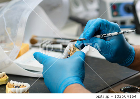 Dental prosthesis work. Teeth painting. Dental prosthesis work. Teeth painting. 102504164