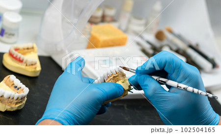 Dental prosthesis work. Teeth painting. Dental prosthesis work. Teeth painting. 102504165