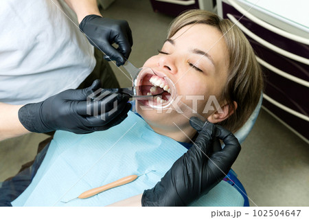 Checkup at dentist. Retractor in patient's mouth 102504647