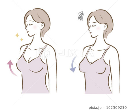 ハリのあるバストと垂れたバストの大人の女性のイラスト　ビフォーアフター 102509250