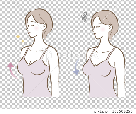 ハリのあるバストと垂れたバストの大人の女性のイラスト　ビフォーアフター 102509250