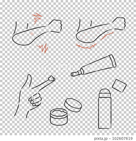 痒みと塗り薬のイラスト 102607619