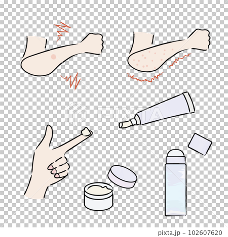 痒みと塗り薬のイラスト　カラー 102607620