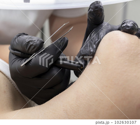 Dermatologist doing hair removal treatment on woman's neck with electrolysis. Electric Epilation In Beauty Salon, Unrecognized Patient. Horizontal Plane. Authentic Photo Dermatologist doing hair removal treatment on woman's neck with electrolysis. Electric Epilation In Beauty Salon, Unrecognized Patient. Horizontal Plane. Authentic Photo 102630107