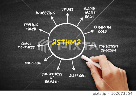 Asthma mind map process on blackboard, medical concept for presentations and reports Asthma mind map process on blackboard, medical concept for presentations and reports 102673354