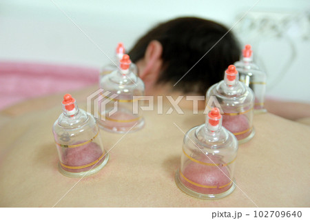 Concept image of cupping and medicine, a traditional oriental medicine Concept image of cupping and medicine, a traditional oriental medicine 102709640