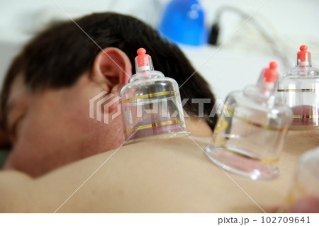 Concept image of cupping and medicine, a traditional oriental medicine 102709641