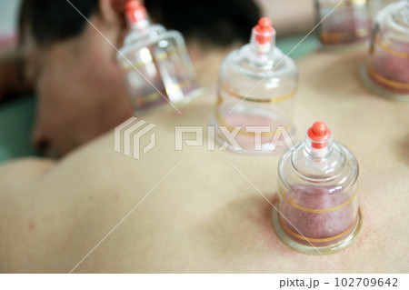 Concept image of cupping and medicine, a traditional oriental medicine 102709642