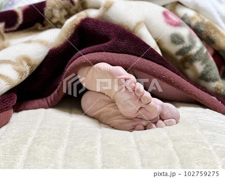高齢女性の足の裏 高齢女性の足の裏 102759275