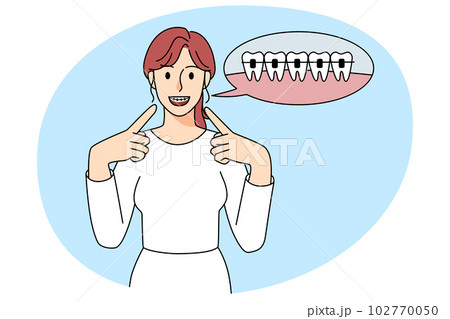 Happy woman point at dental braces on teeth 102770050