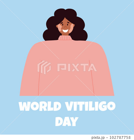 A woman with vitiligo skin disease accepts her appearance, loves herself. World Vitiligo Day. vector illustration. Poster with a happy girl with vitiligo. 102787758