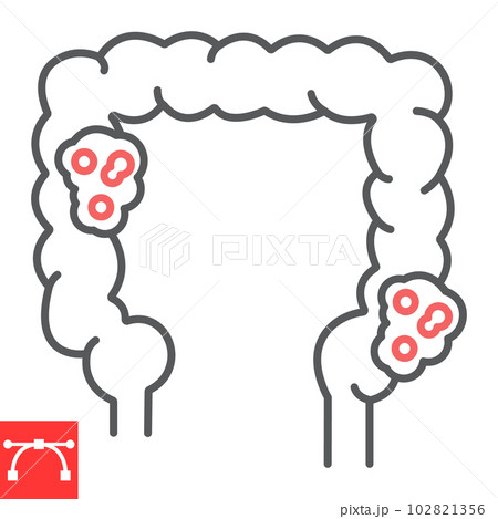 Bowel cancer line icon, oncology and tumor, colon cancer vector icon, vector graphics, editable stroke outline sign, eps 10. Bowel cancer line icon, oncology and tumor, colon cancer vector icon, vector graphics, editable stroke outline sign, eps 10. 102821356