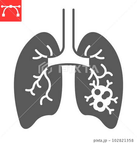 Lungs cancer glyph icon, oncology and medicine, lungs tumor vector icon, vector graphics, editable stroke solid sign, eps 10. 102821358
