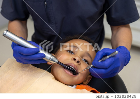 Dark-skinned boy looking scared while dentist treating his teeth 102828429