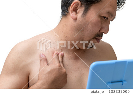 middle age senior man worry about skin tags or acrochordon on his neck isolated 102835009