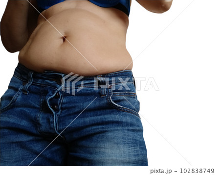 Saggy belly. Folds of leather and fat on the - Stock Photo [102838749] -  PIXTA