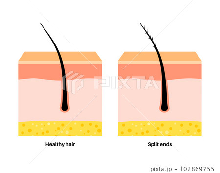Split and normal hair 102869755