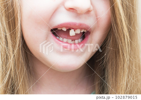 portrait little girl open mouth 