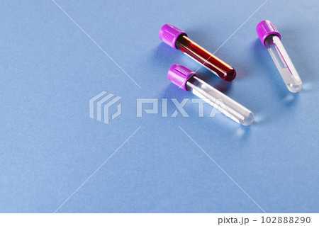 Three sample tubes with purple lids, one containing blood, on blue background with copy space 102888290
