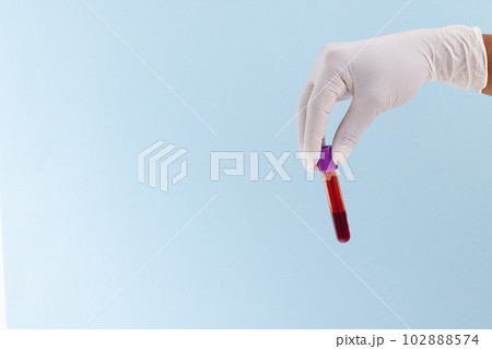 Hand in white surgical glove holding blood sample tube, on blue background with copy space Hand in white surgical glove holding blood sample tube, on blue background with copy space 102888574