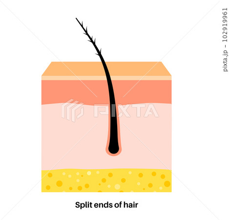 Split hair ends 102919961