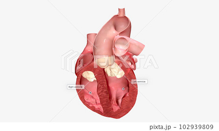 Several heart conditions can cause the septum of the heart to thicken. 102939809