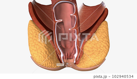 Anal warts are painless, growths along the skin near the anal canal. Most anal warts are caused by human papillomavirus (HPV). 102940534