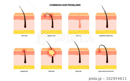 Common hair problems 102954611