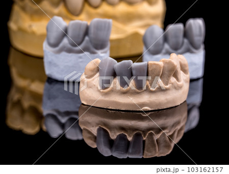 Artificial tooth 103162157