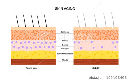 Skin aging poster Skin aging poster 103168468