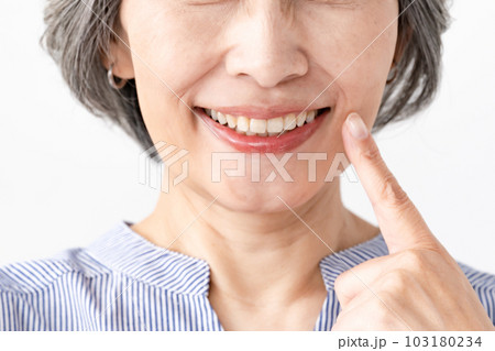 デンタル　口元　歯 103180234