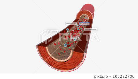 Blood Flow with Antinuclear Antibody Blood Flow with Antinuclear Antibody 103222706