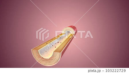 By reducing the amount of angiotensin II, vasopressin is not released. 103222729