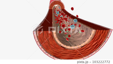Blood Flow with Antinuclear Antibody Blood Flow with Antinuclear Antibody 103222772