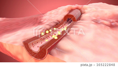 Artery dilates due to increase of ARBs in the blood 103222848