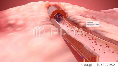 Artery dilates due to increase of ARBs in the blood 103222952